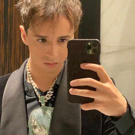 Слава Марлоу показал результат после пересадки волос